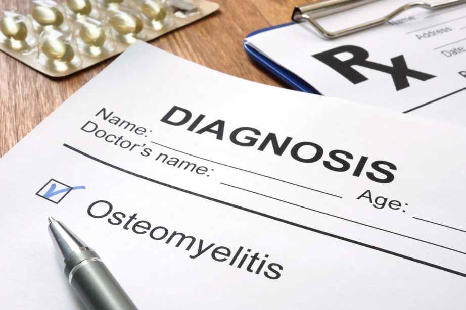 Diagnóstico de Osteomielite como funciona